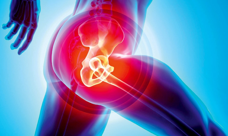 Hip Replacement Loosening Treatment in Chandigarh