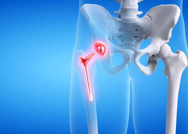 robotic hip replacement Chandigarh