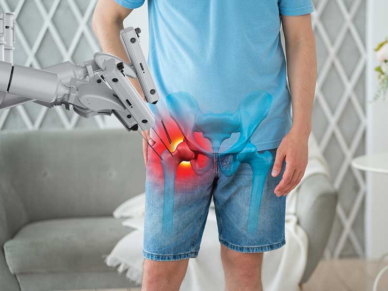  Robotic Hip Surgery in Tricity