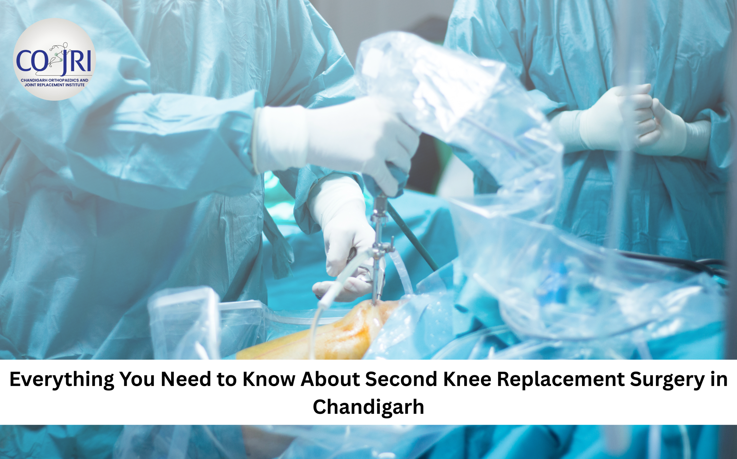 Second Knee Replacement Surgery in Chandigarh