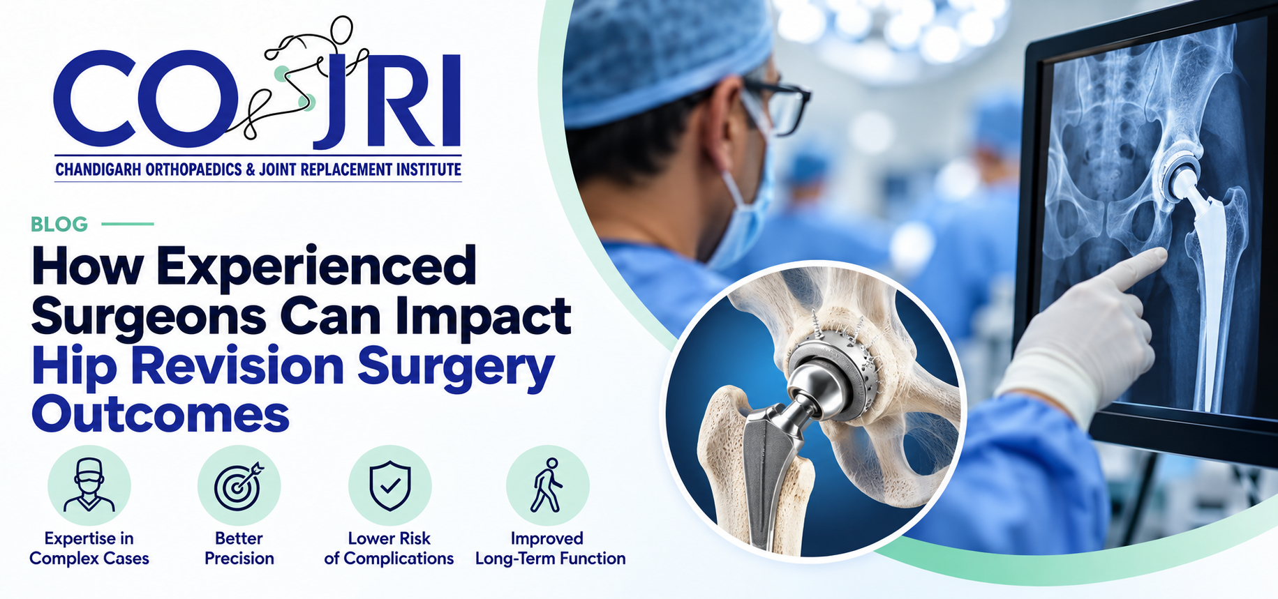 Hip revision surgery success rate